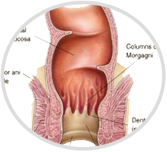 Bariatric-Surgery